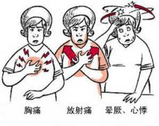 冠心病有哪些癥狀？