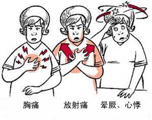冠心病有哪些癥狀？(圖1)