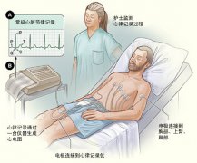 冠心病需要做哪些檢查？