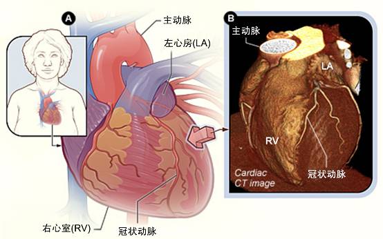 冠心病需要做哪些檢查？(圖2)