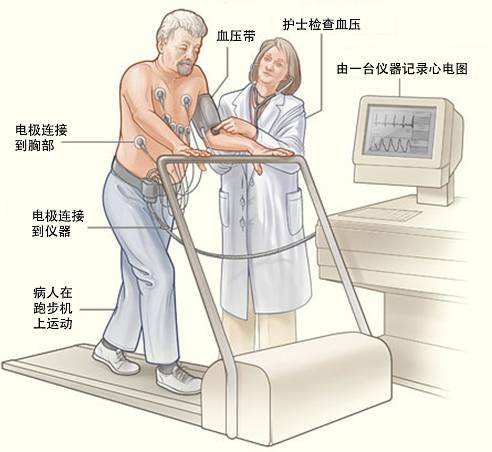 冠心病需要做哪些檢查？(圖3)